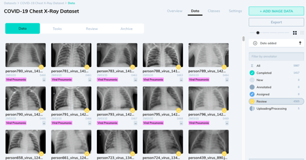 V7 Labs & CloudFactory Release Annotated X-Ray Dataset to Aid in COVID-19 Research