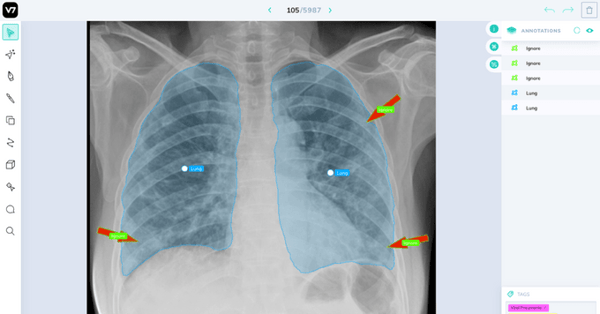 3 Opportunities for Image Annotation to Improve Our World