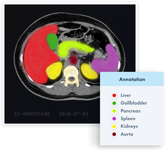 annotation-graphics-internal-organs