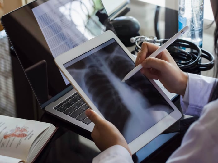 expertise-in-segmenting-annotating-radiographs
