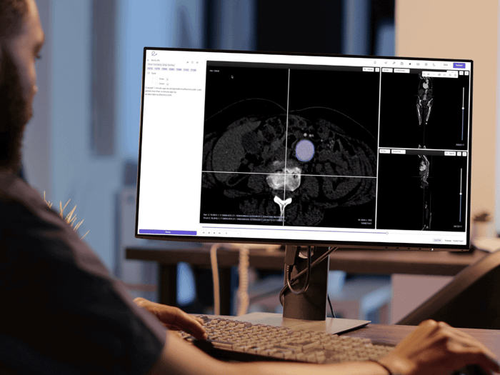 data-analyst-precisely-annotating-medical-image
