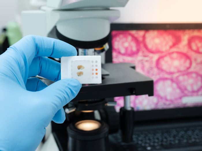 Sartorius-accurate-image-annotation-speeds-medical-research-breakthroughs