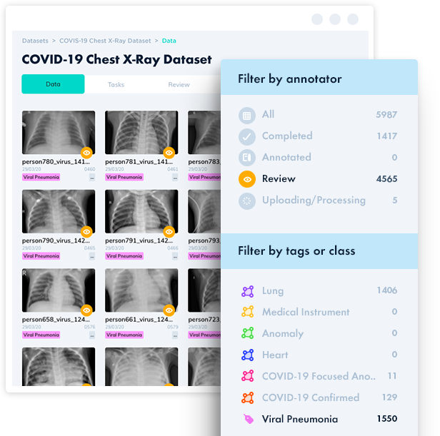 Covid-19-chest-x-ray-dataset