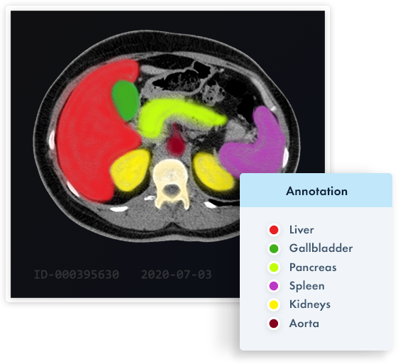 Segmentation