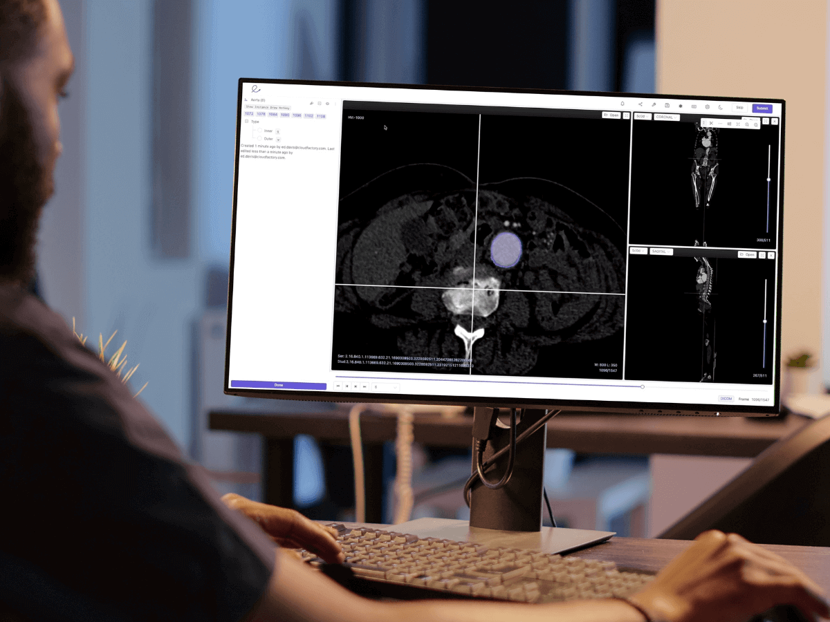 A data analyst precisely annotates a medical image for a healthcare AI company to support building medical device AI training models.
